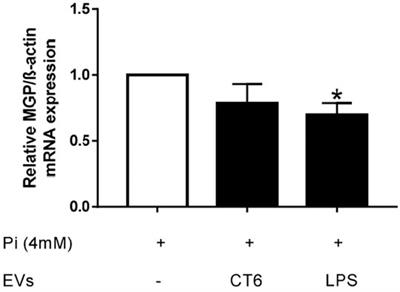 Extracellular Vesicles From LPS-Treated Macrophages Aggravate Smooth Muscle Cell Calcification by Propagating Inflammation and Oxidative Stress